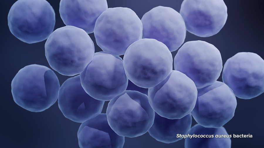 Microscopic view of a cutaneous bacterial infection