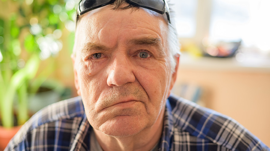 Man suffering from partial facial palsy