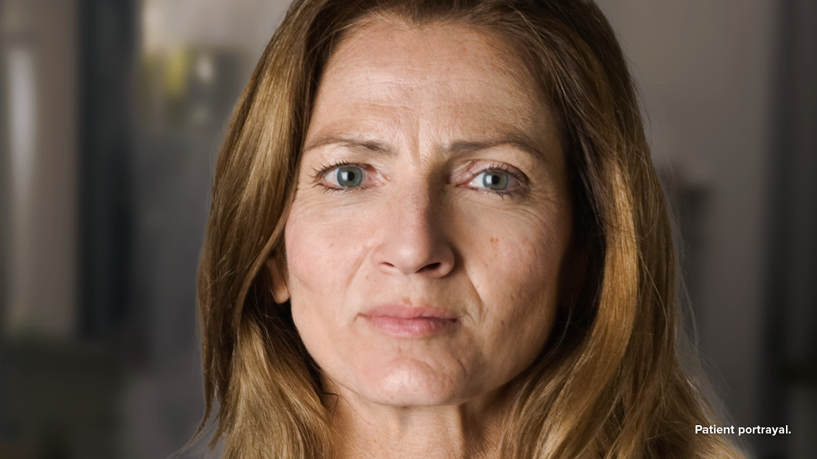 Image of a 51-year-old female